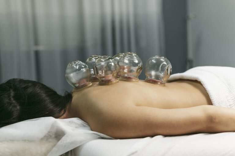 acupuncture services cupping in Winchester